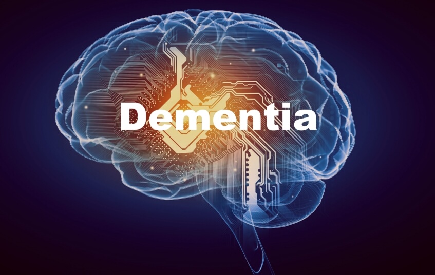 Dementia leading cause of death in women in England blog image